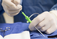 Adhesives used in catheter assembly